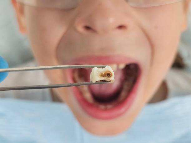 Best Same-Day Emergency Dentist in Churubusco, IN