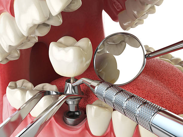 Best Emergency Dental Care for Trauma or Injury in Churubusco, IN